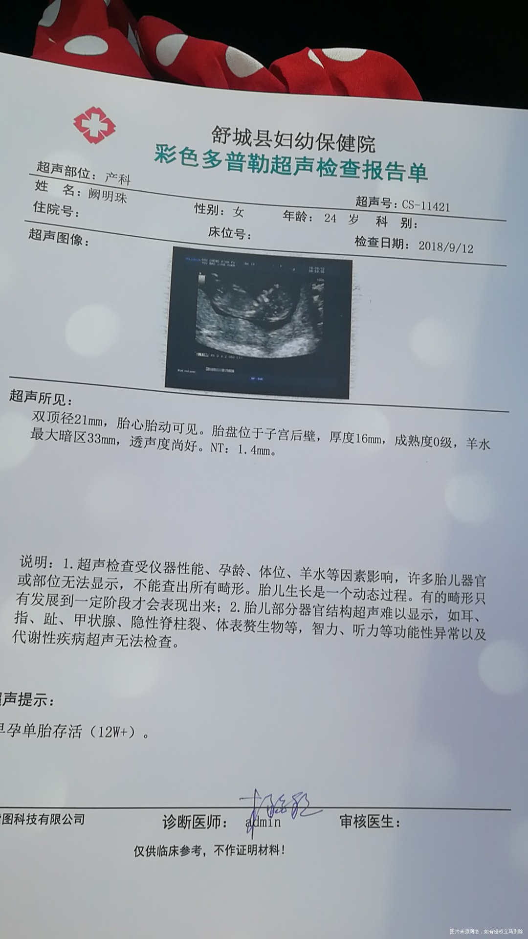 我12周多去查了nt,但是我不确定我这个是不是nt啊,