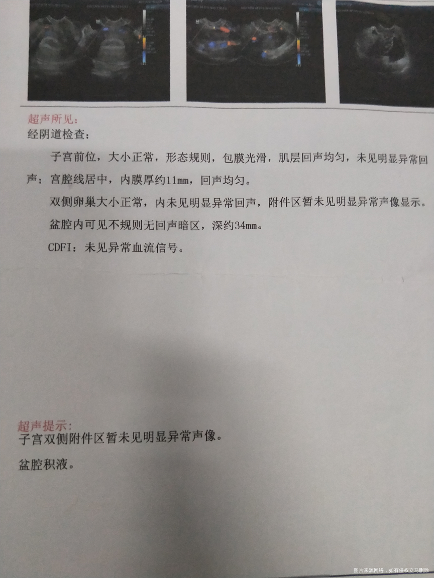 这样的检查结果是多囊好了吗