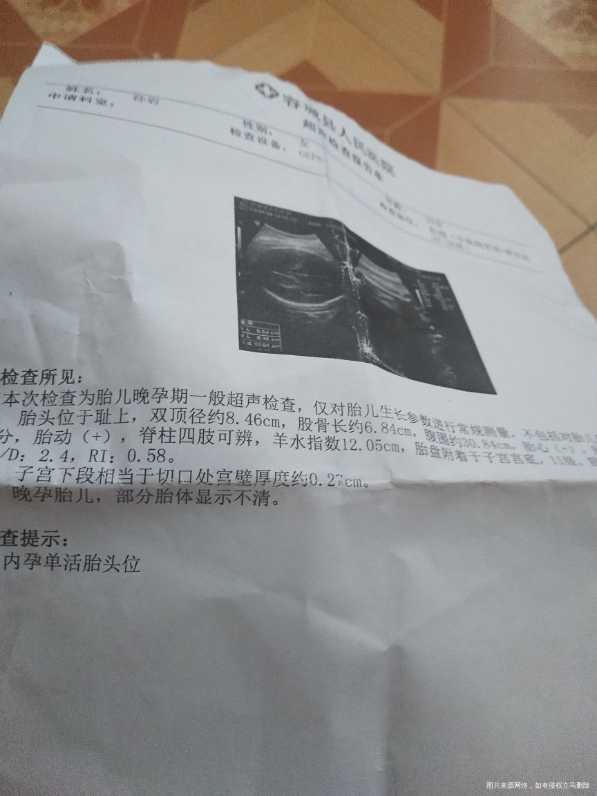 医生帮忙看看谢谢!宝宝有几斤