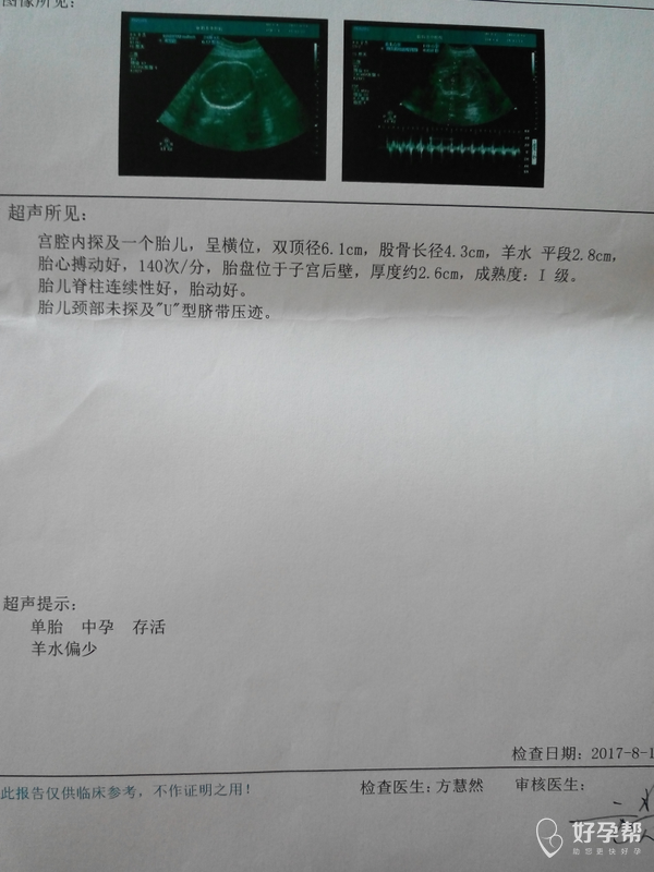 医生帮忙看看单子,羊水怀孕27周羊水少