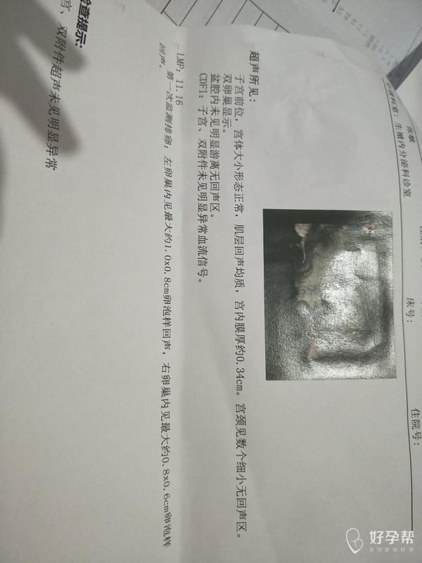 我检查了白带和彩超,宫颈筛查的结果还没拿到,医生说中度宫颈糜烂