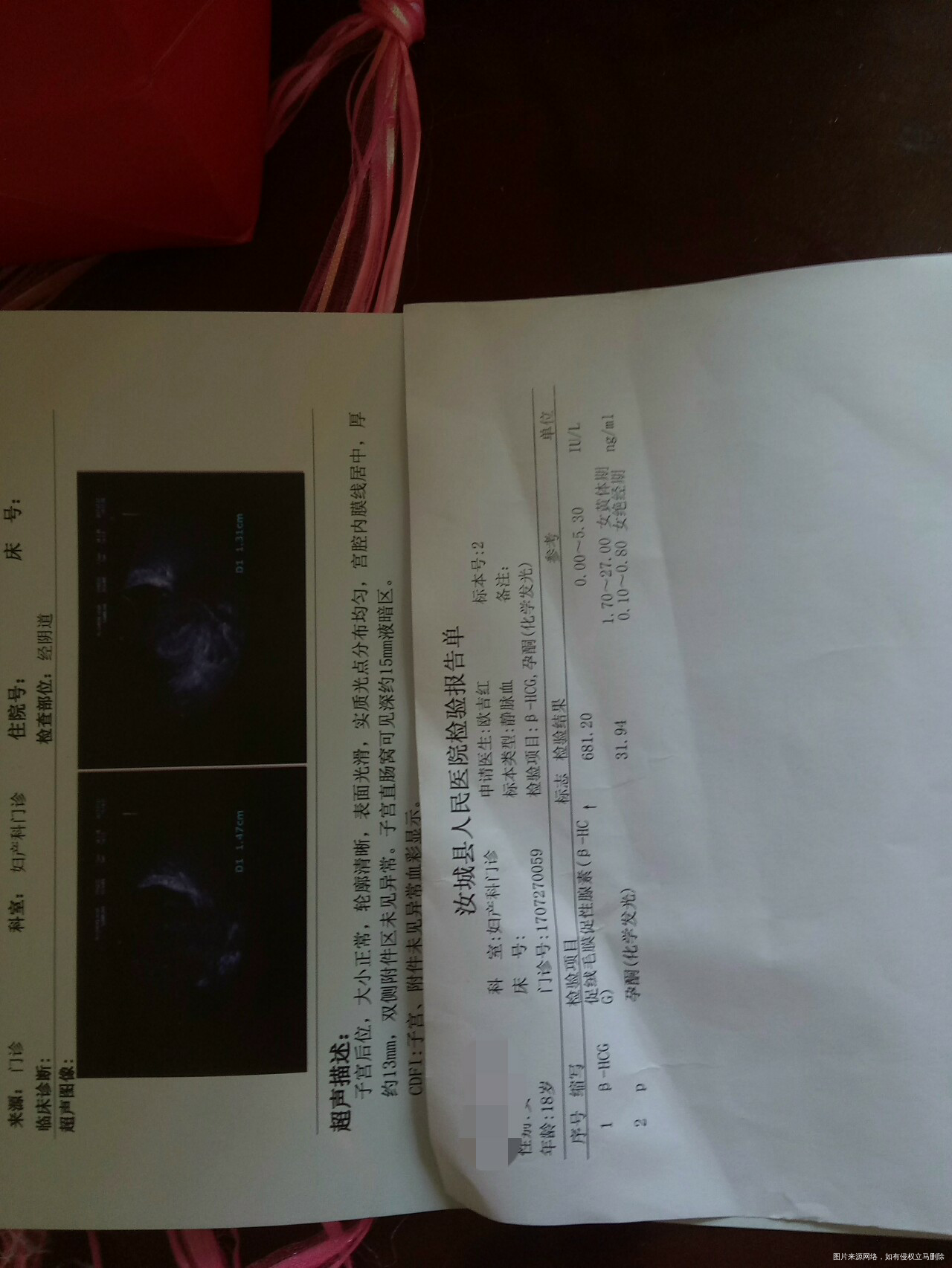 正常吗?姨妈推迟六天去做b超没查出来,什么都没有