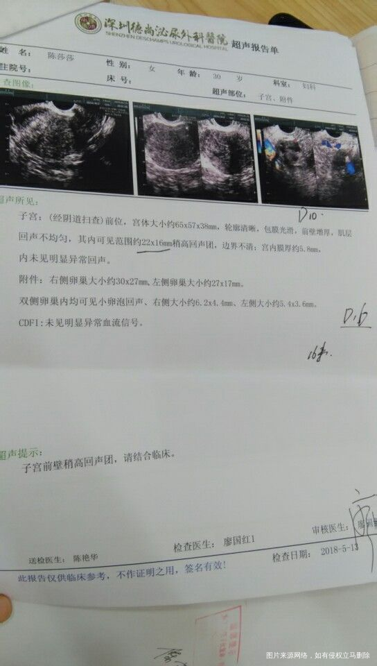 帮我看一下卵泡发育,谢谢