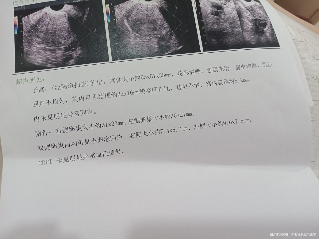 帮我看一下卵泡发育,谢谢