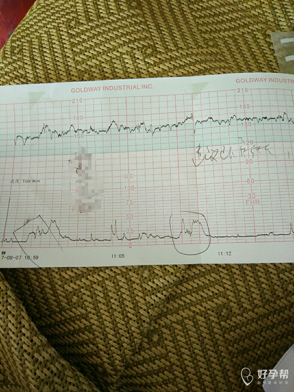 麻烦医生看看是不是宫缩很厉害