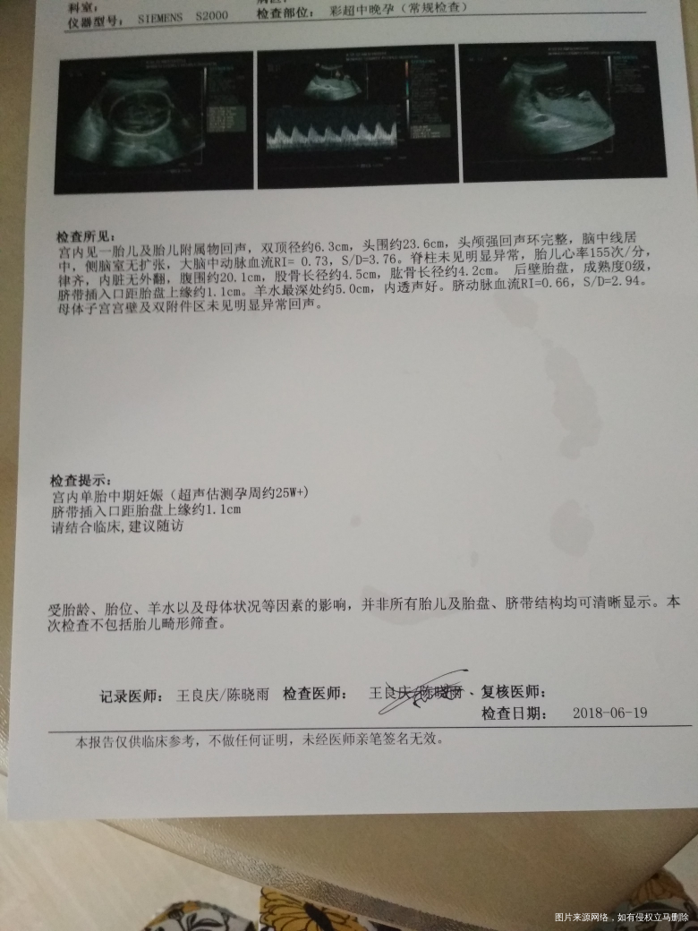 帮忙看看彩超单吧,之前忘记添加附近了!!!