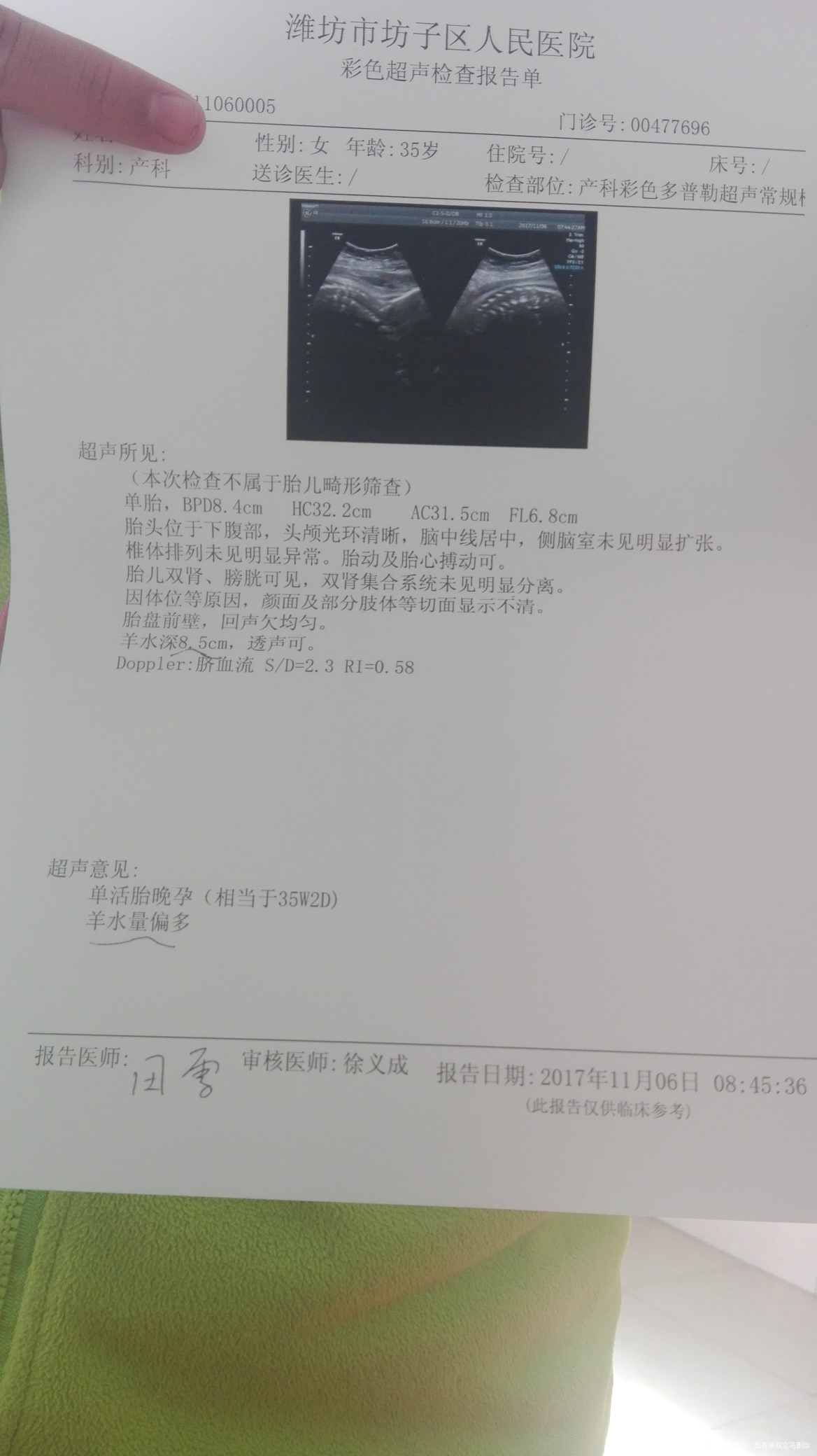 求助在线的医生帮忙看看,