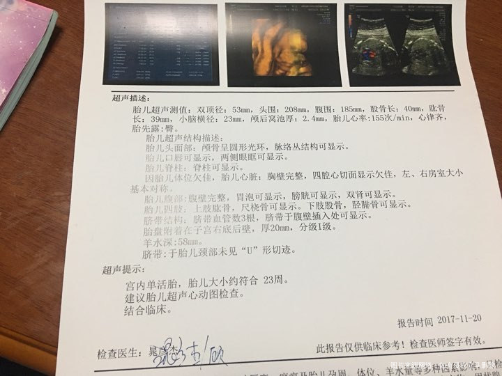 今天23周做了四维超,帮忙看结果