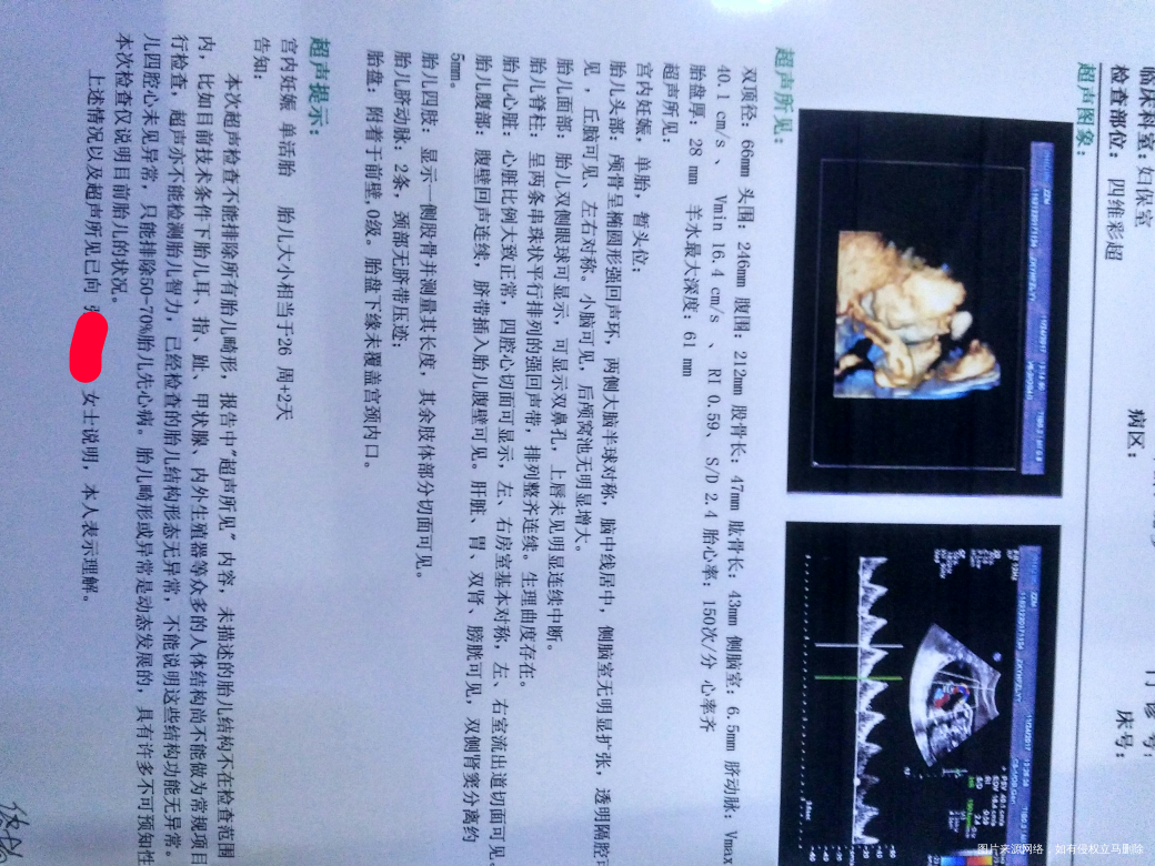 好失望,好难受,别人看了四维单子说是男孩