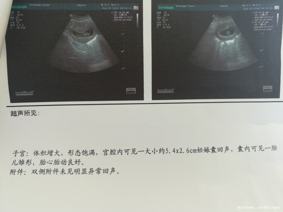 两次b超,胎儿长大了,孕囊变小了怎么回事