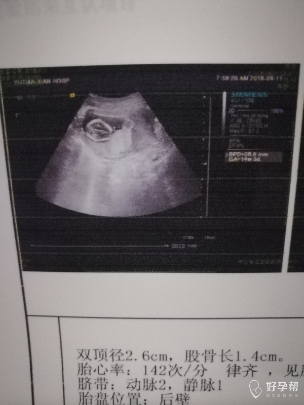 帮忙看看宝宝发育正常吗