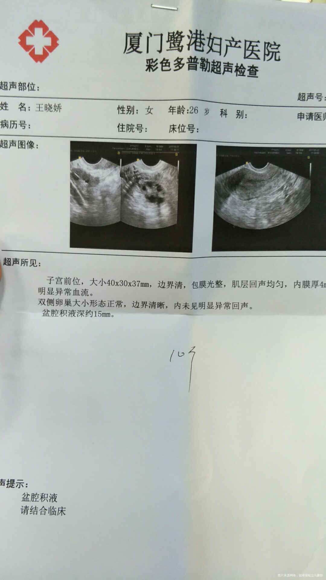 麻烦医生帮我看看,急求谢谢