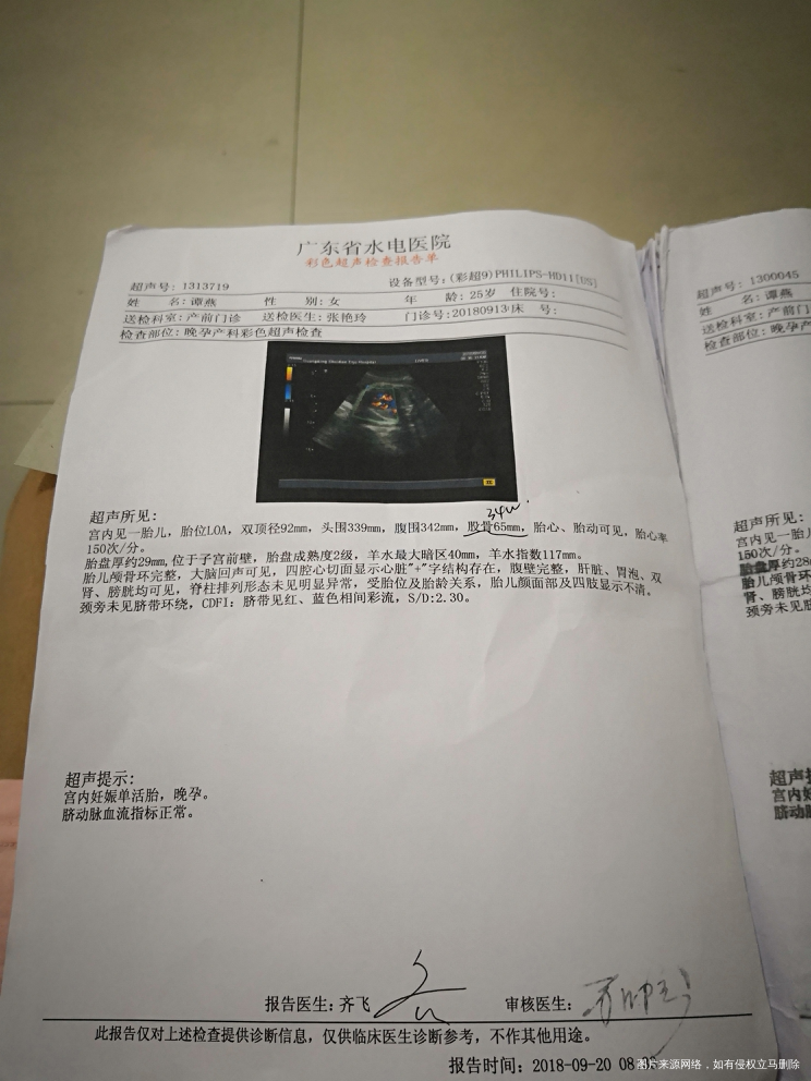 胎儿发育的怎样?现在有几斤?