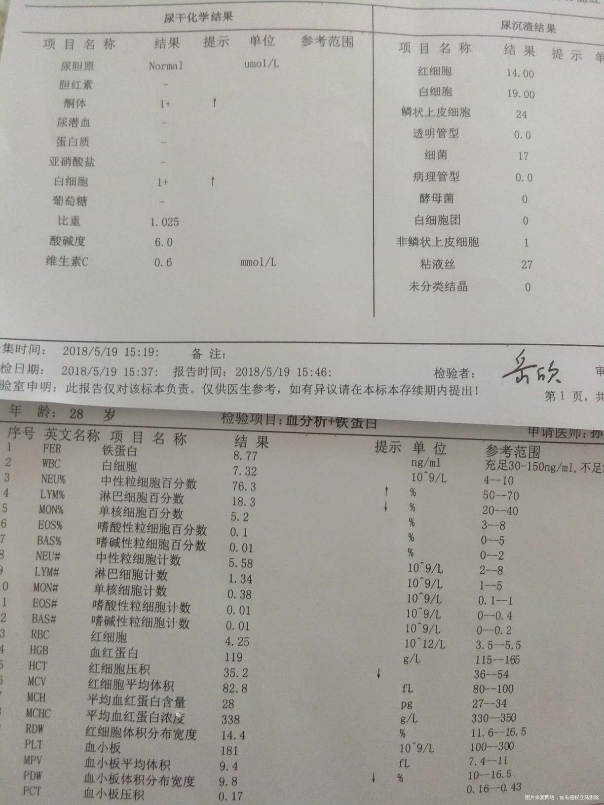 入院待产前的抽血结果,哪几项不合格?影响大吗