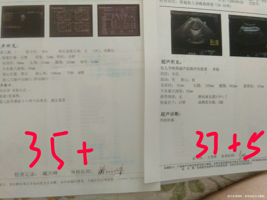 请医生帮忙看一下胎儿腹围是不是长得太快了