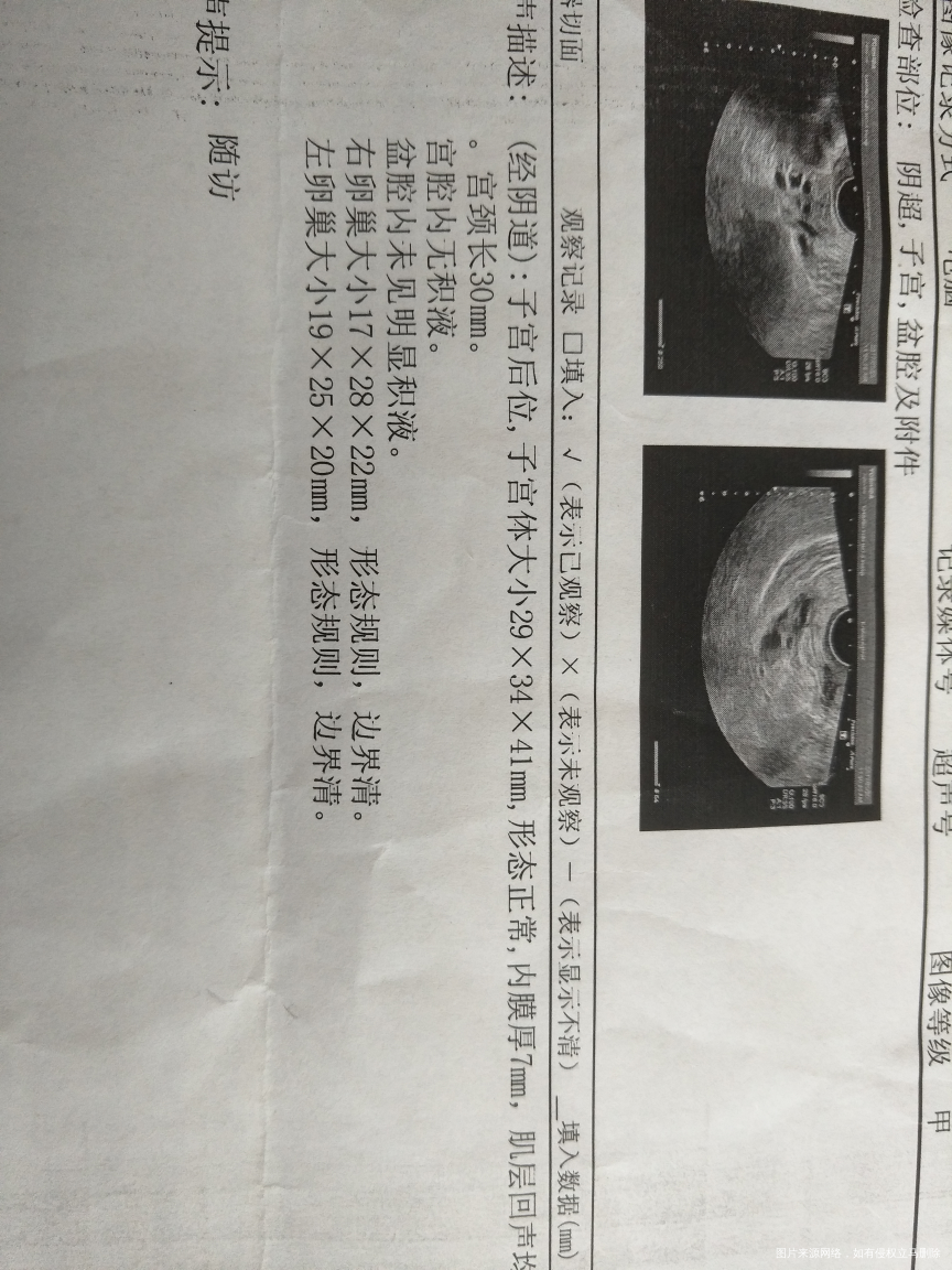 在线医生有吗,帮忙看一下谢谢