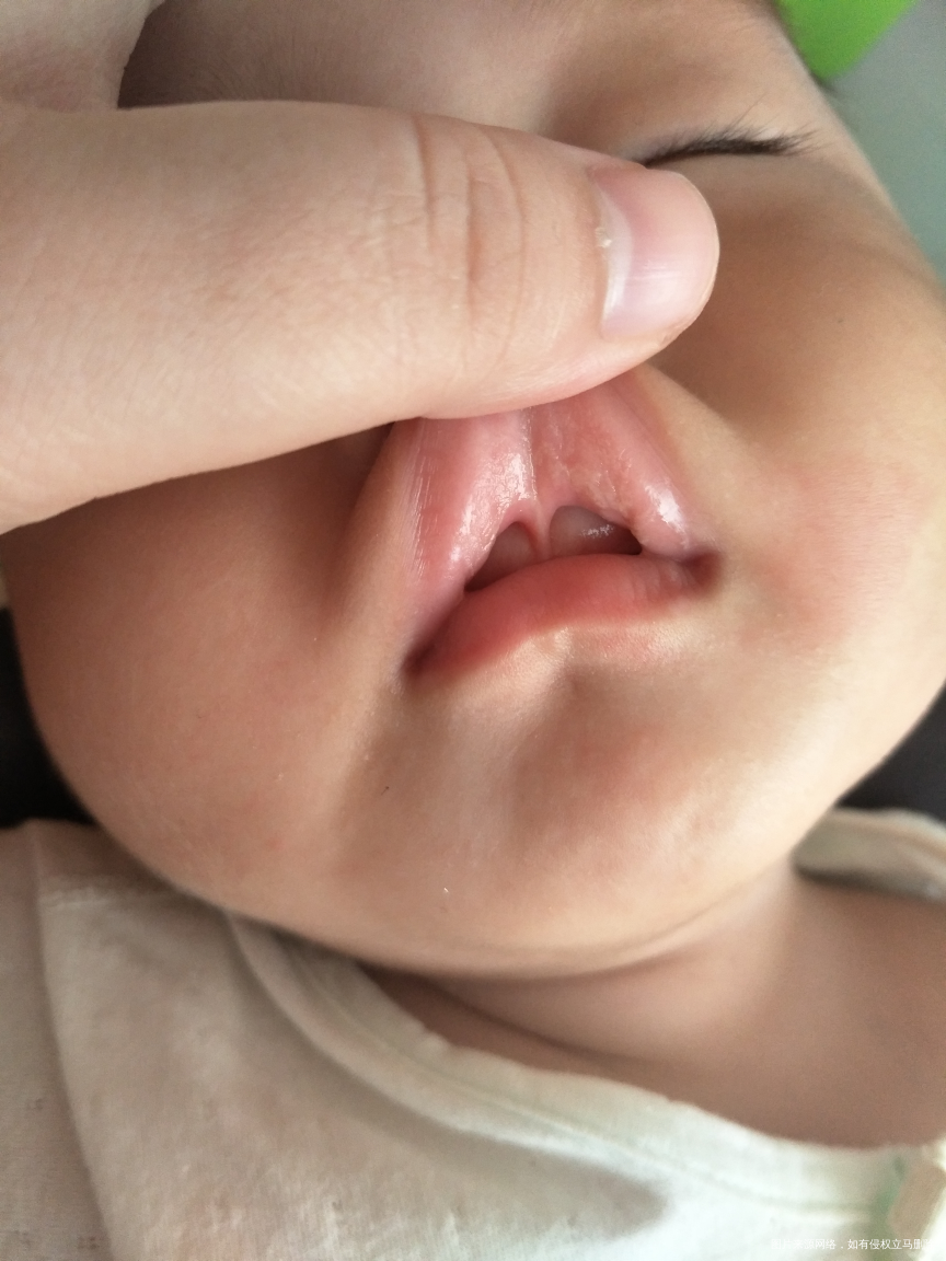 五个半月宝宝这俩天看了舌苔好白怎么回事