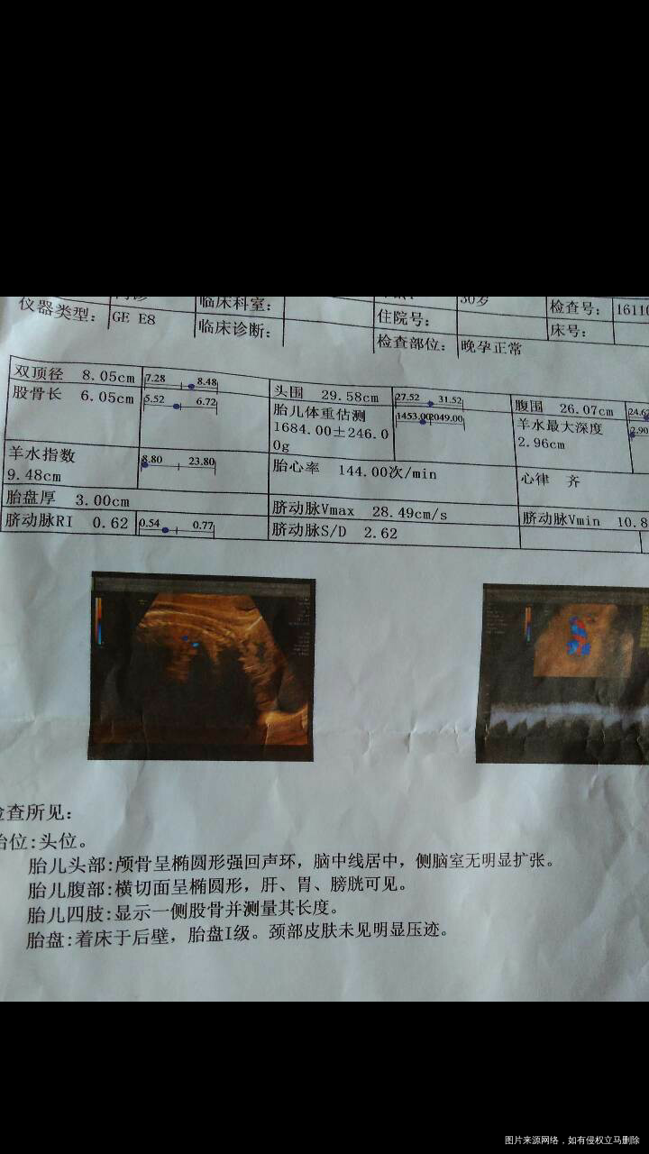 和大家分享一下羊水少的问题