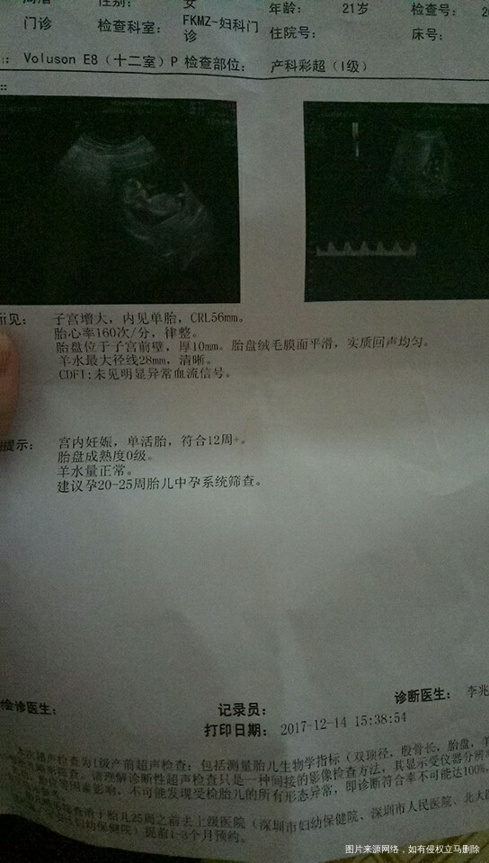 怀孕三个月头疼怎么办?