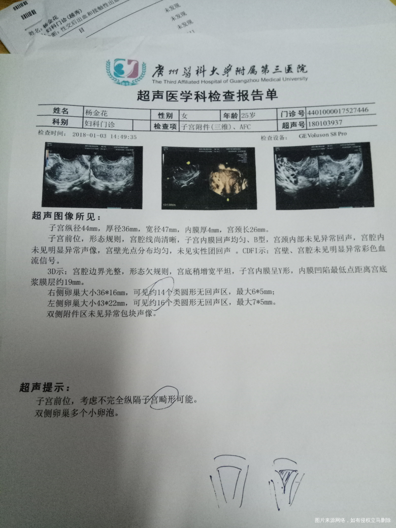 最近大半年,月经量越来越好了。去做了b超。结果是这样。怎么办。