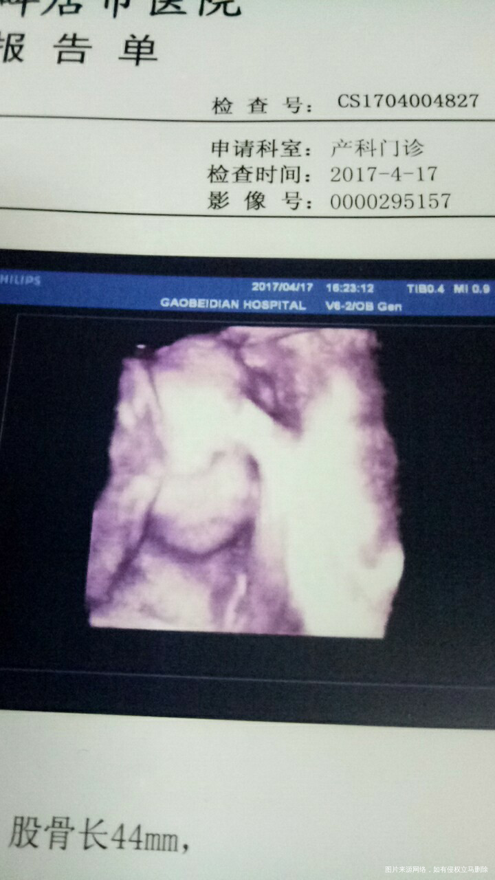 今天是24+2周,四维彩超的日子