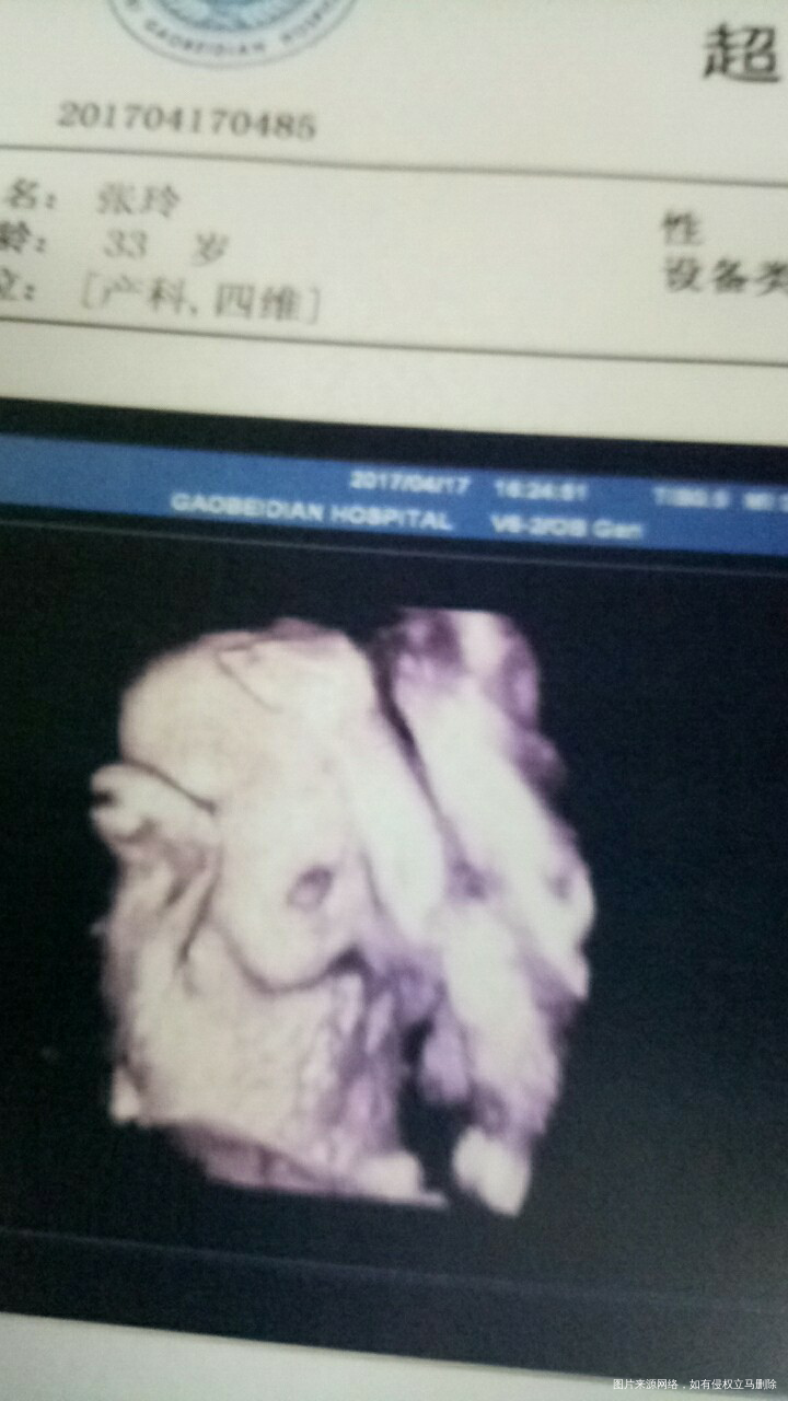 今天是24+2周,四维彩超的日子