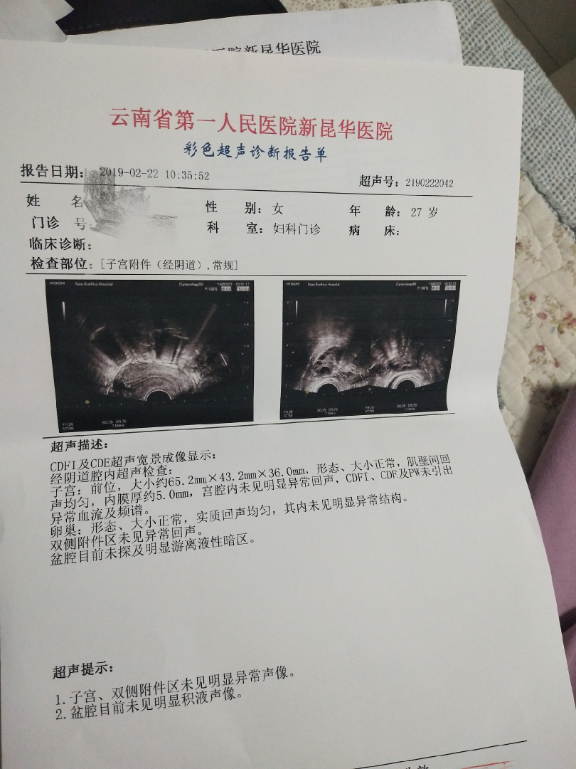 麻烦好孕帮的医生帮忙看下白带检验报告单