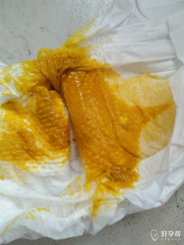 宝宝四个月零八天了偶尔拉点但是偶尔不愁不稀--试管婴儿论坛-好孕帮