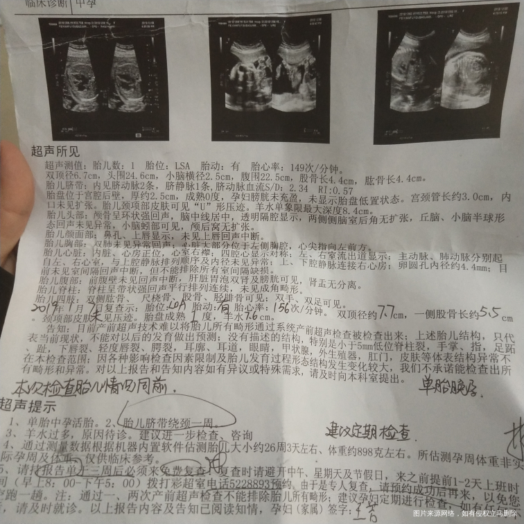 复查大排畸结果宝宝怎么样了