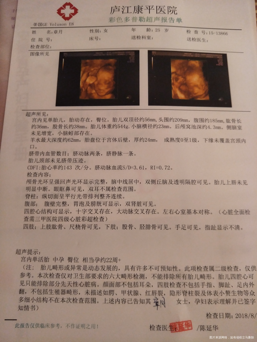 这是今天做的四维报告麻烦医生看看结果怎么样啊
