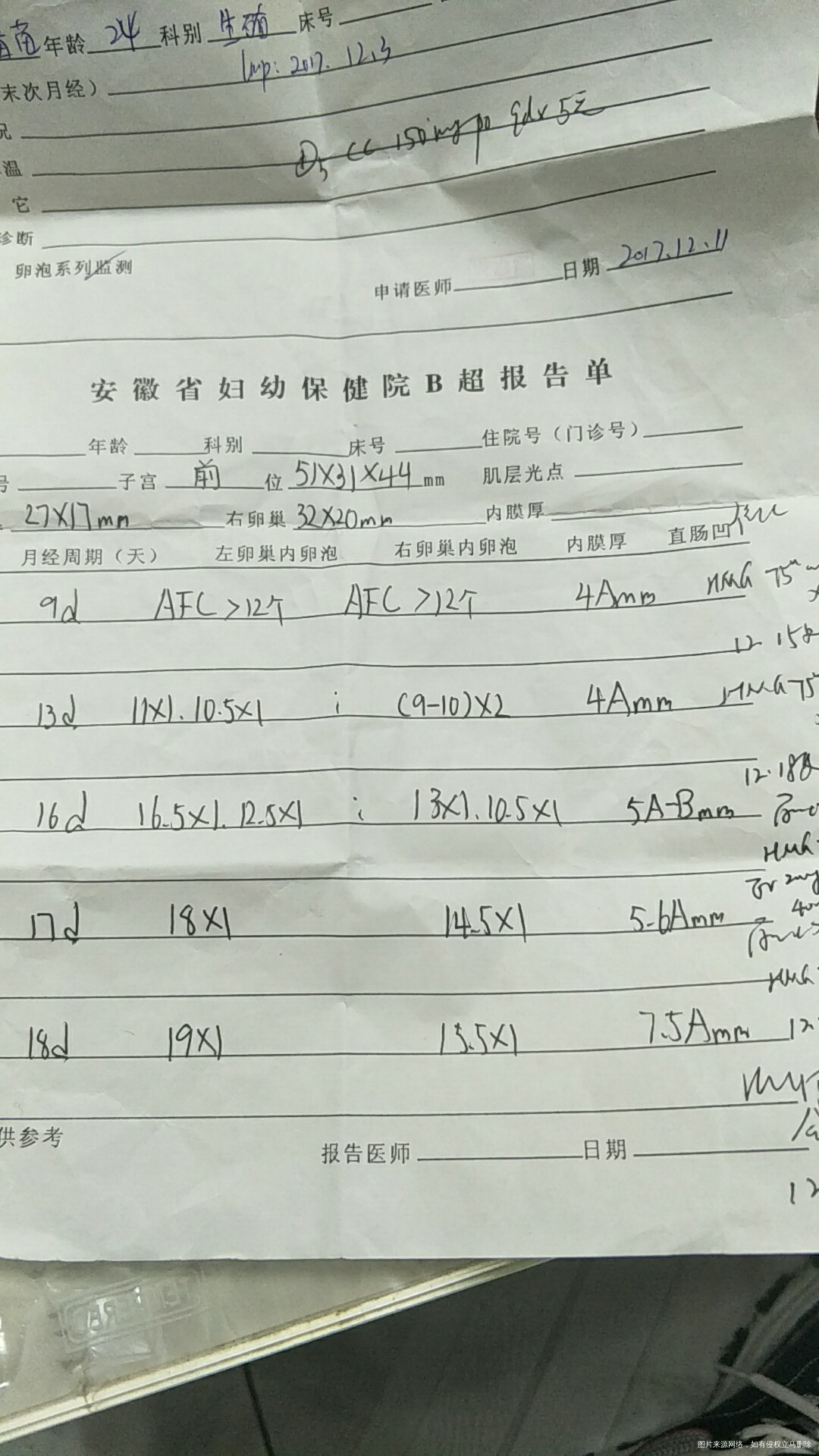 我的卵泡是不是质量不好,不够圆?