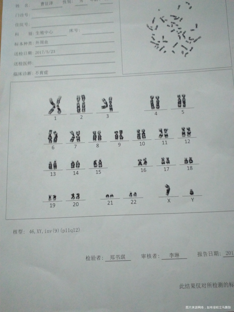 医生你好我老公的染色体不好我移植三次失败,给这有关系吗?