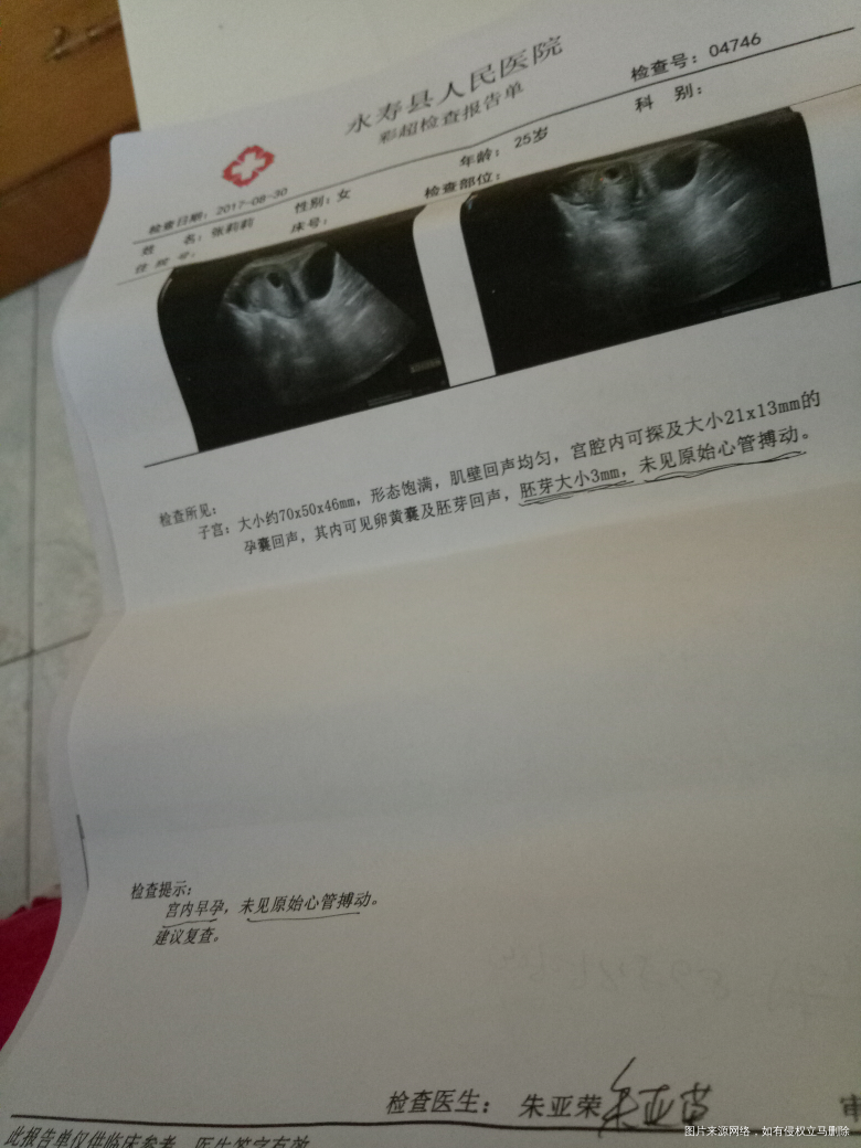 今天做的,未见原始心管博动