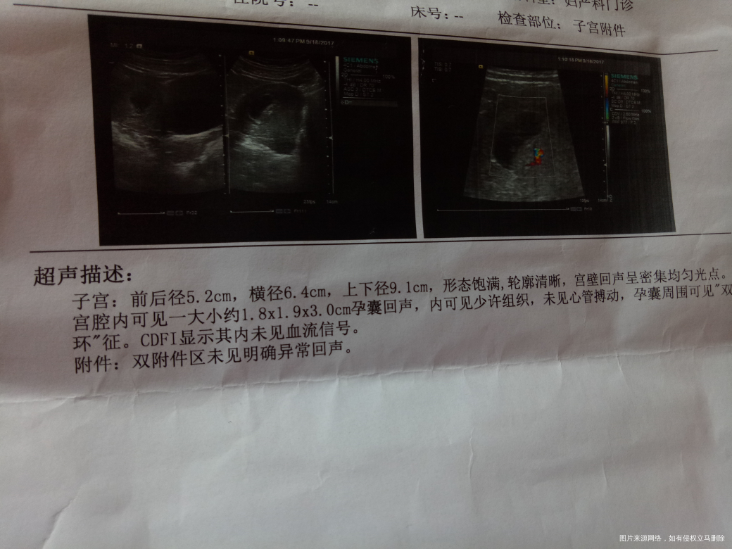 医生们帮我看下,我这个情况还需要继续观察吗?末次月经7月7号,排卵日22号,