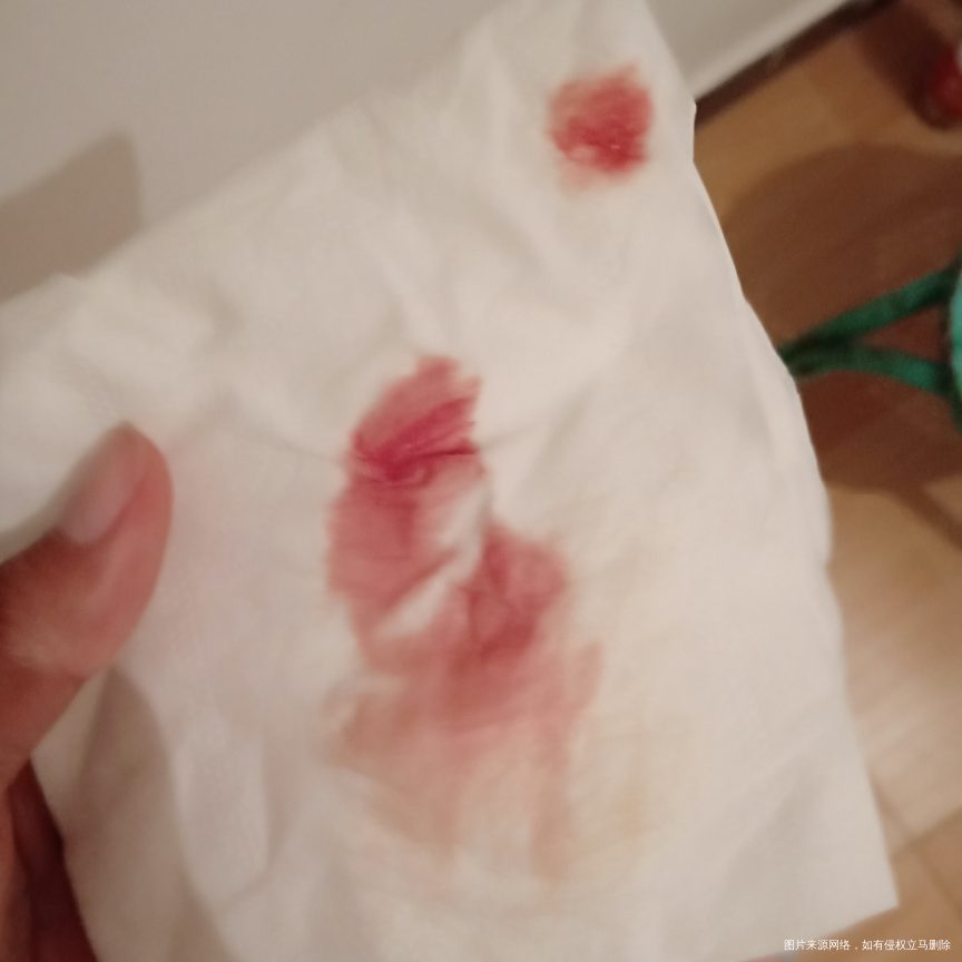 白天做腹部B 超。晚上流血