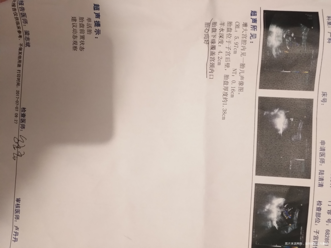 哪位医生帮我看一下,好担心啊