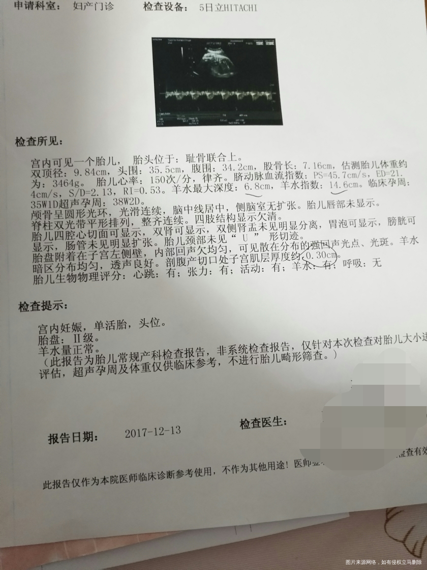 麻烦医生们帮我看一下,二胎,我应该什么时候去去医院待产?