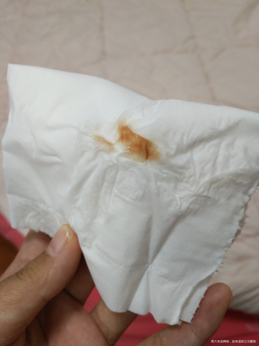 恶露老是反复,请医生帮忙看一下。