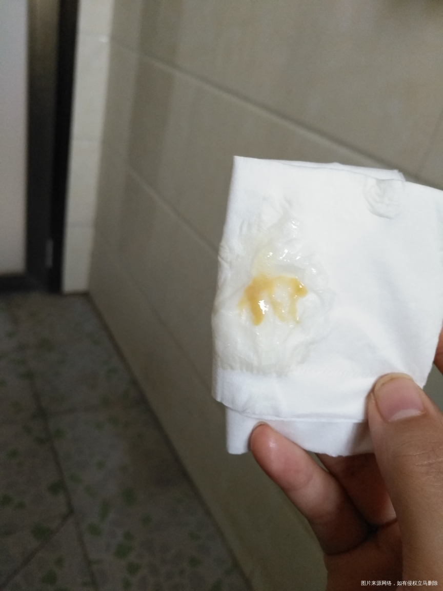 医生帮我看一下,怎么成这个颜色了?