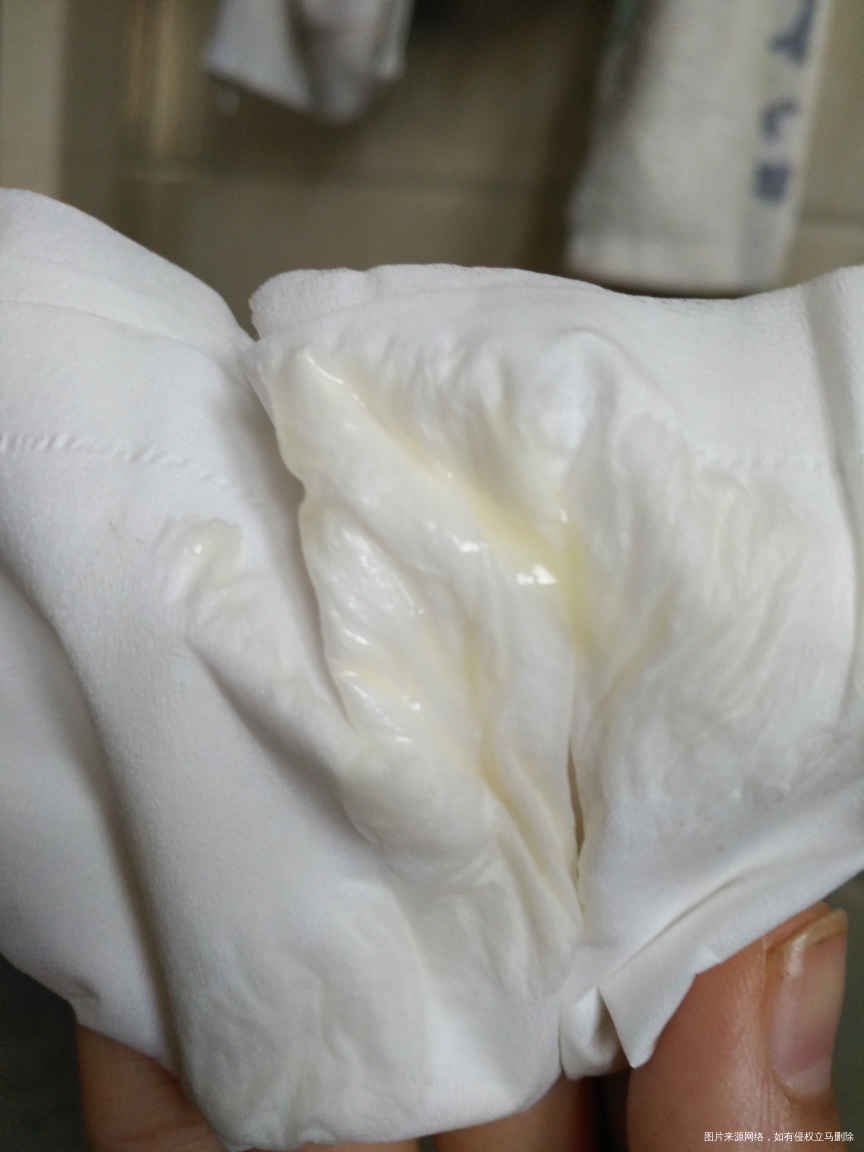 医生帮我看一下,怎么成这个颜色了?