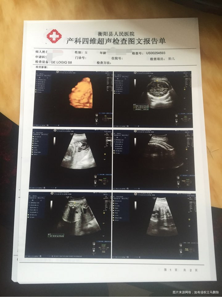 有医生在吗?帮我看看胎儿发育的怎么样?多重了大概?