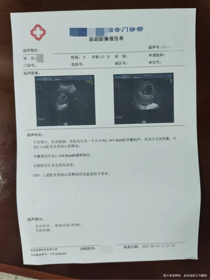 胎心正常 高领也可以要宝宝