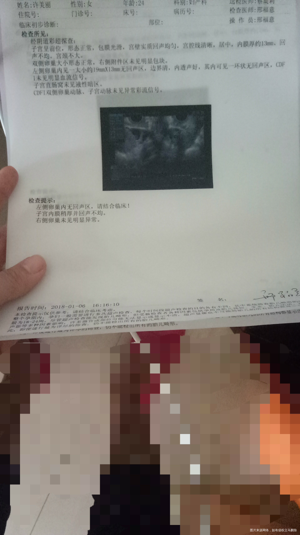 有医生在吗,帮忙看下,急