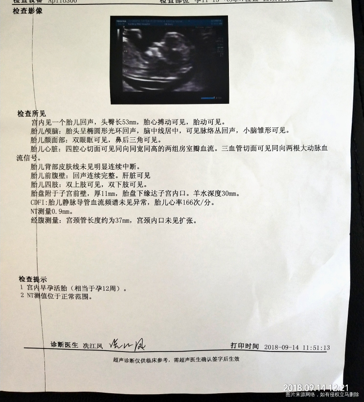 今天做NT一次通过,哈哈