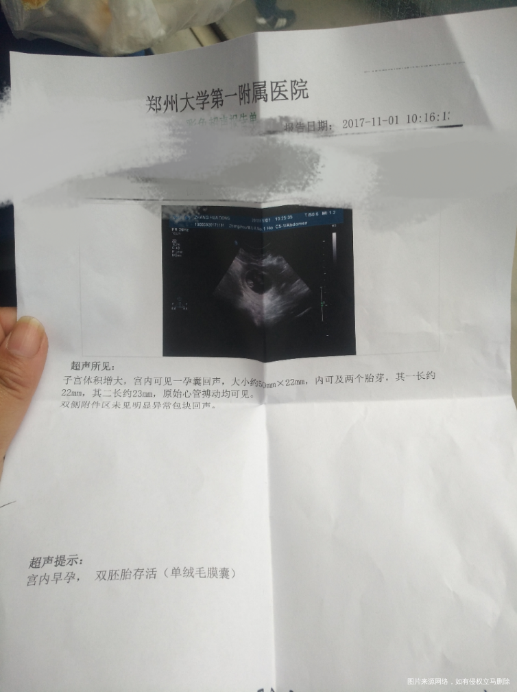 二胎终于好孕了,不容易啊!