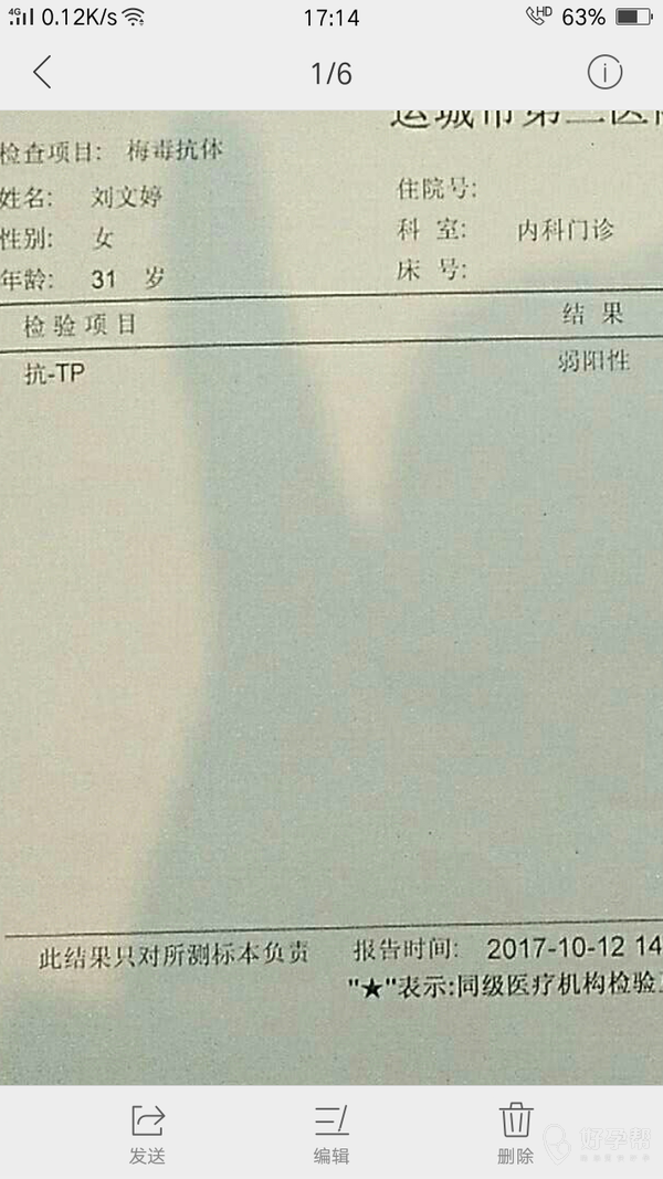 怀孕检查梅毒抗体几次都不一样