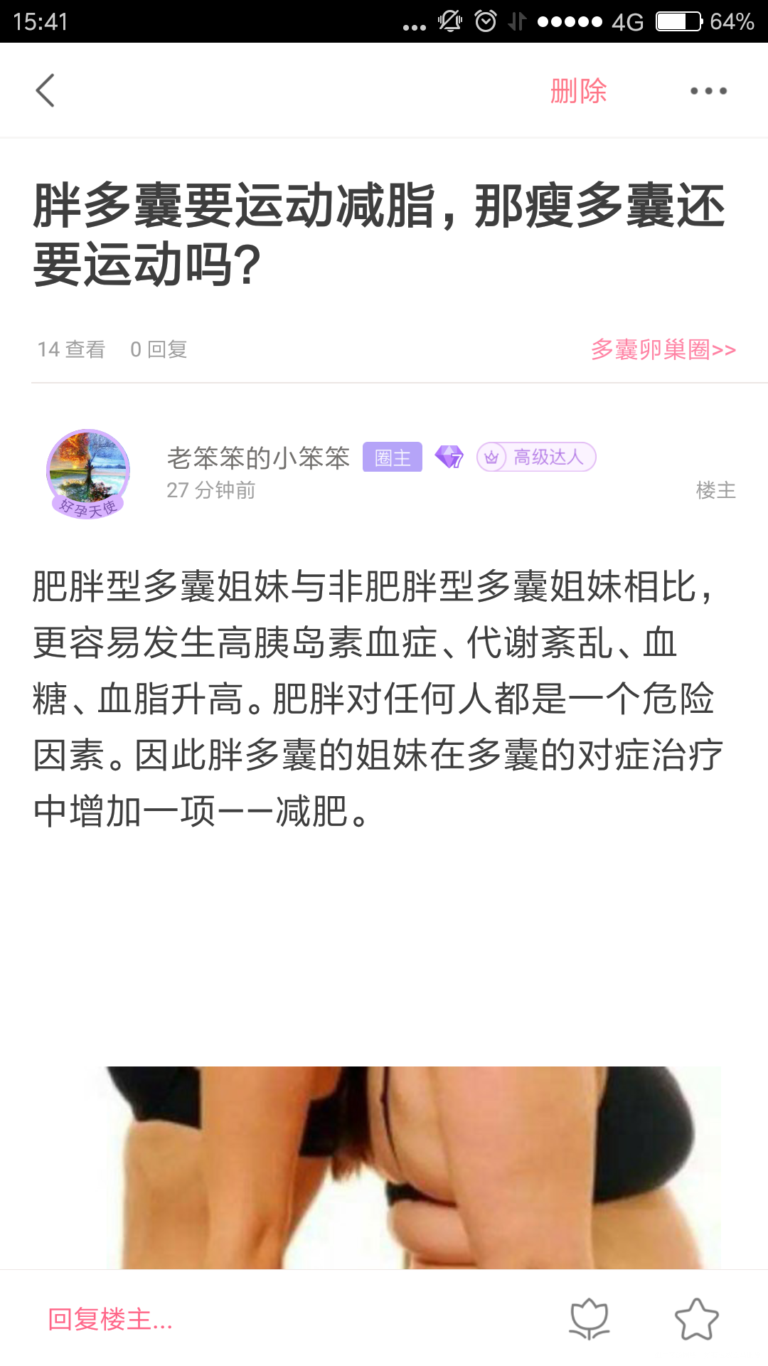 多囊卵巢圈又出新话题啦