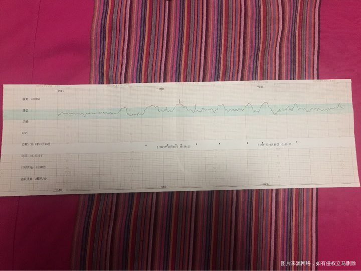 大夫,可以帮我看下我得胎心监护单吗?孕38周