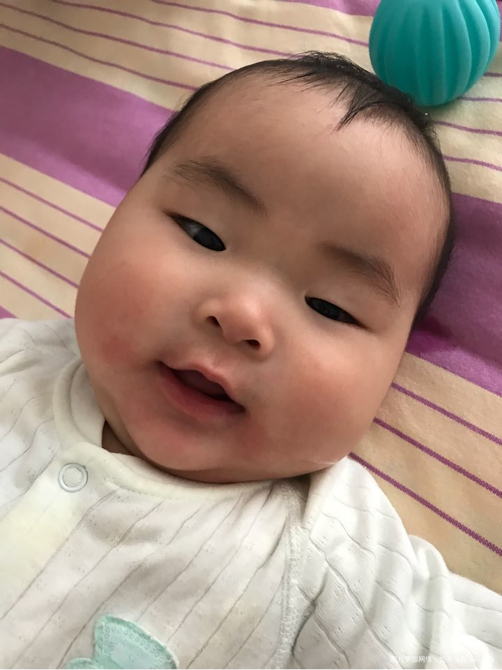 6月宝宝突然奶粉过敏