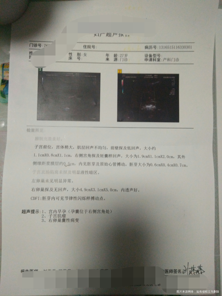 右侧宫角妊娠,想保住孩子,希望大吗?